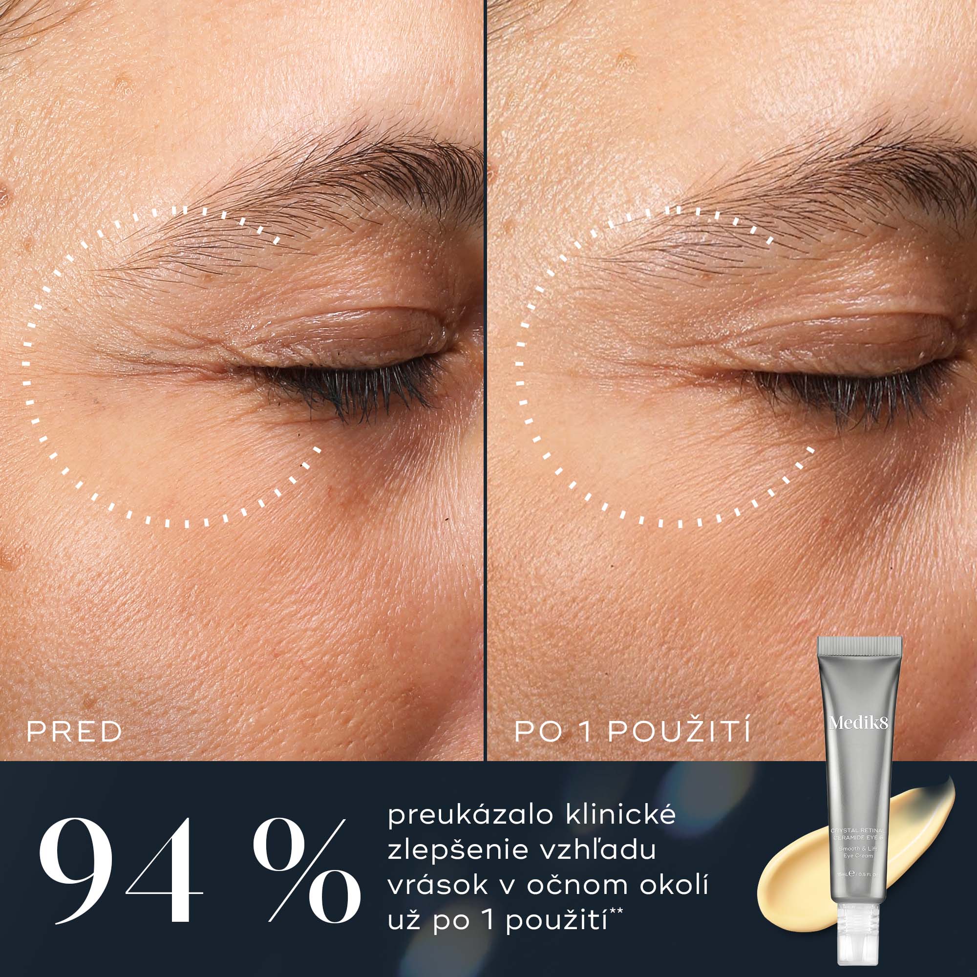 Crystal Retinal® Ceramide Eye