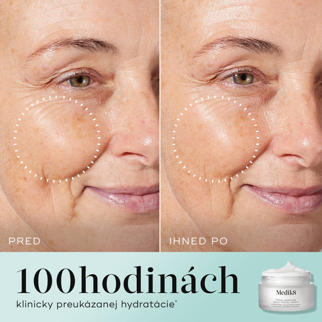 Total Moisture Daily Facial Cream™