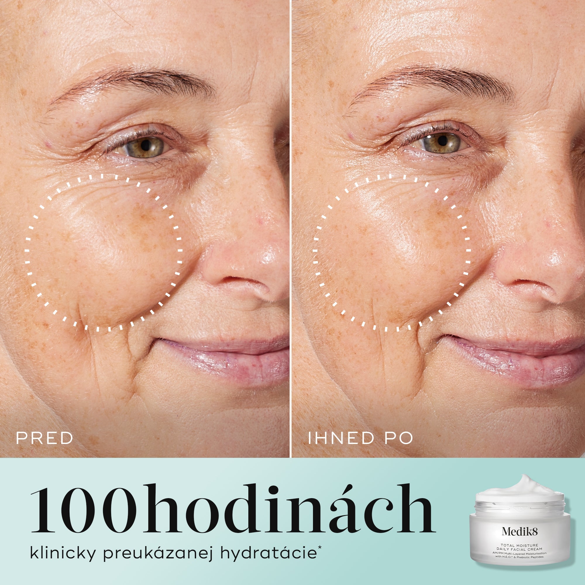 Total Moisture Daily Facial Cream™