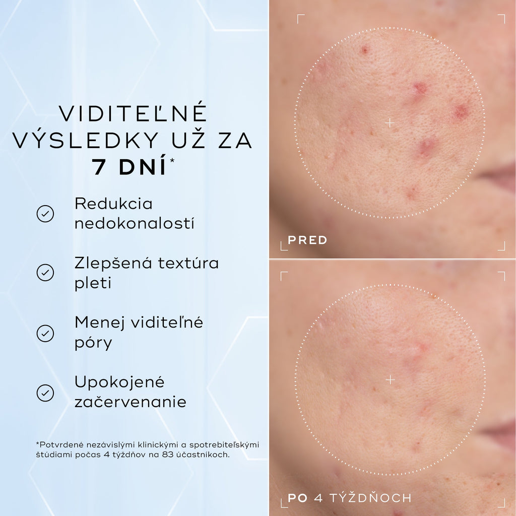 Niacinamide Peptides™