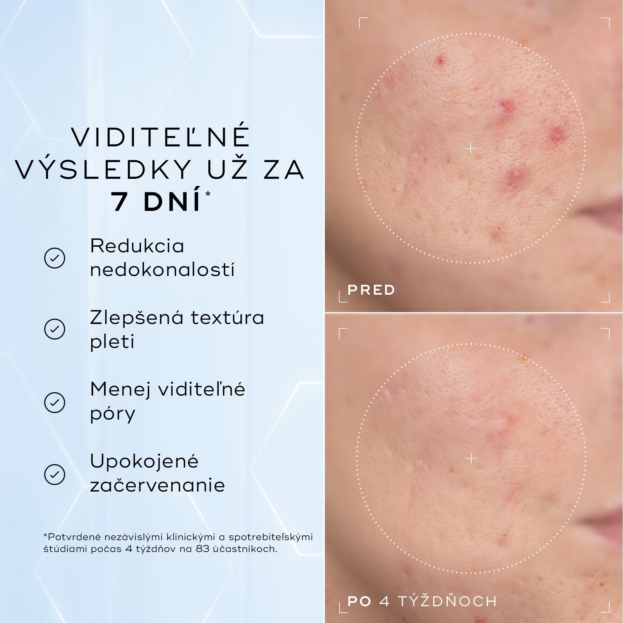 Niacinamide Peptides™