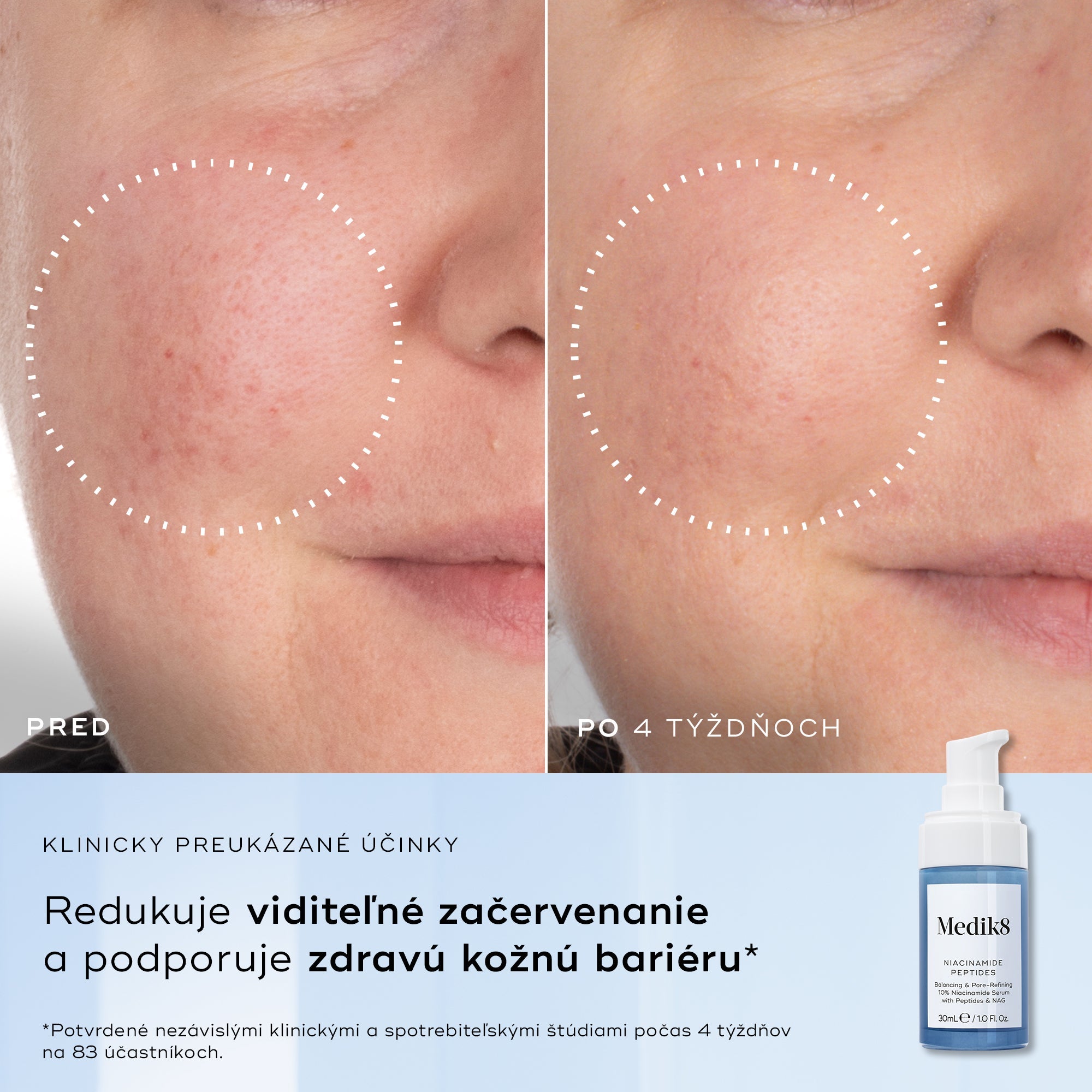 Niacinamide Peptides™