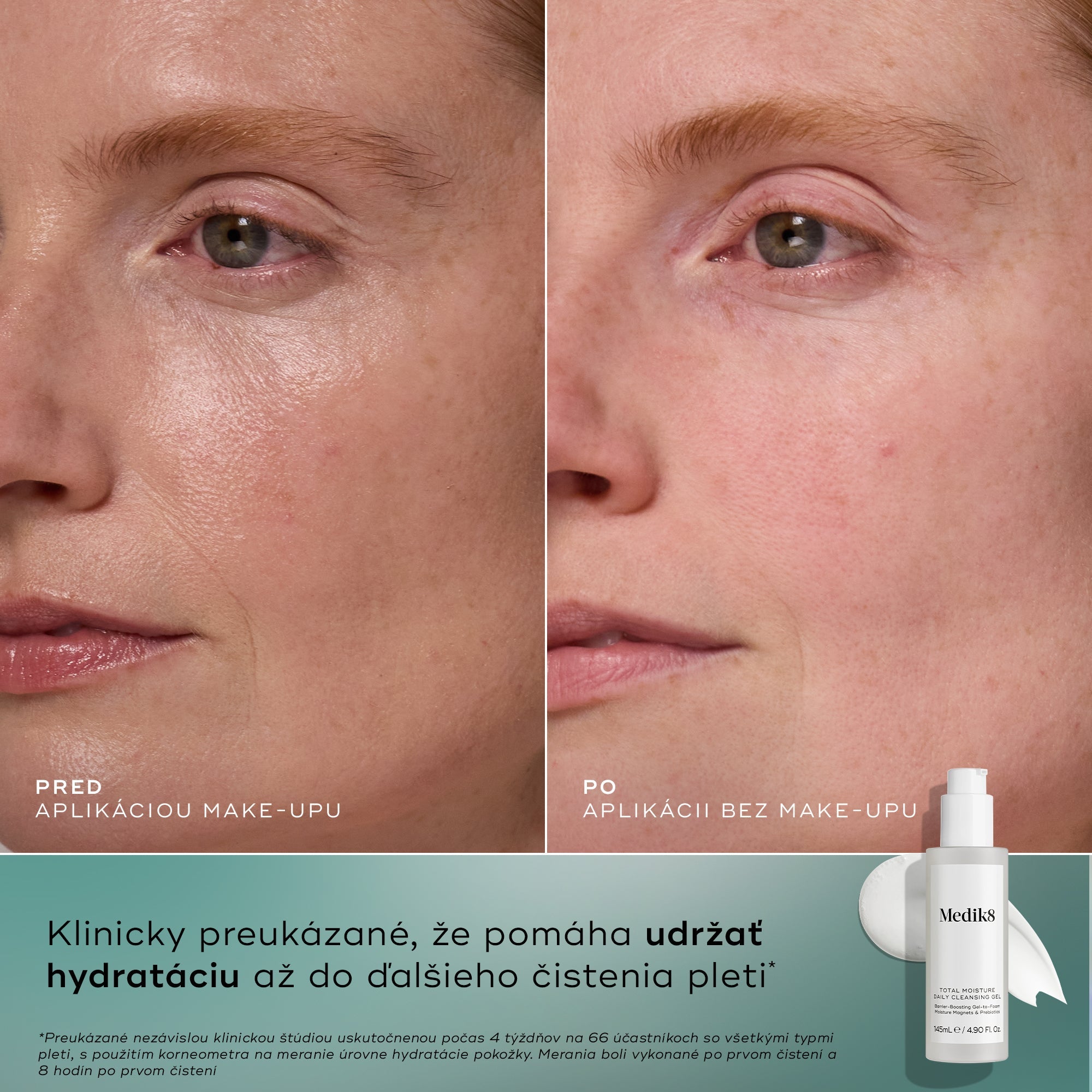 Total Moisture Daily Cleansing Gel